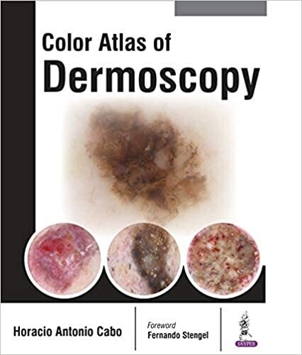 Color Atlas of Dermoscopy 1st Edition