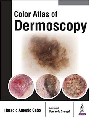 Color Atlas of Dermoscopy 1st Edition