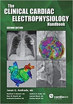 The Clinical Cardiac Electrophysiology Handbook, Second Edition 2021