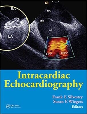 Intracardiac Echocardiography 1st Edition,