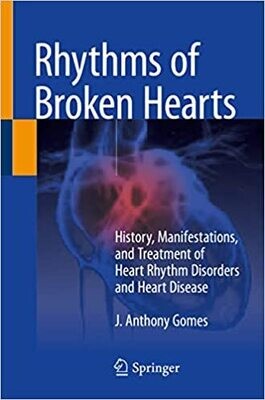 Rhythms of Broken Hearts: History, Manifestations, and Treatment of Heart Rhythm Disorders and Heart Disease 1st ed. 2021 Edition