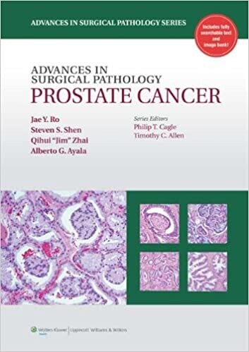 Advances in Surical Pathology Prostate Cancer (Advances in Surgical Pathology) 1st Edition