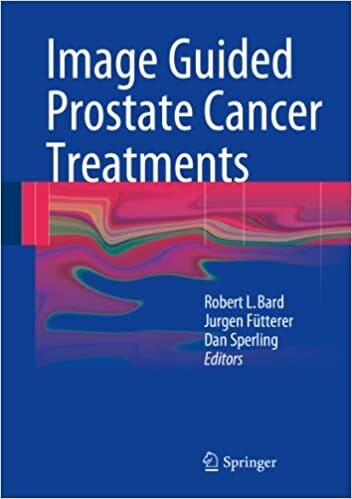 Image Guided Prostate Cancer Treatments 2014th Edition