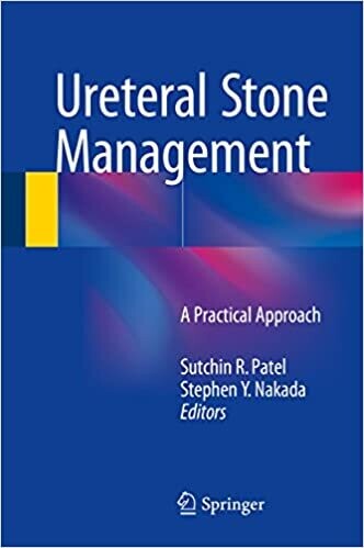 Ureteral Stone Management: A Practical Approach 2015th Edition