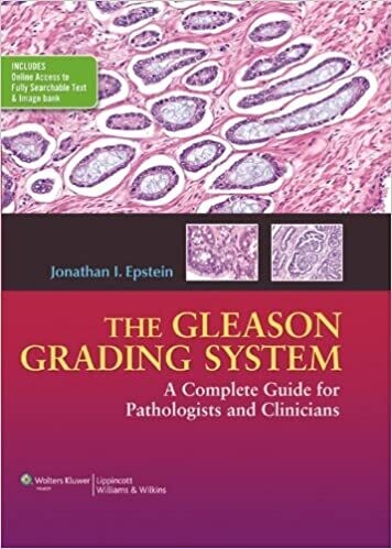 The Gleason Grading System: A Complete Guide for Pathologist and Clinicians 1st Edition