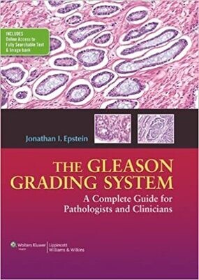 The Gleason Grading System: A Complete Guide for Pathologist and Clinicians 1st Edition