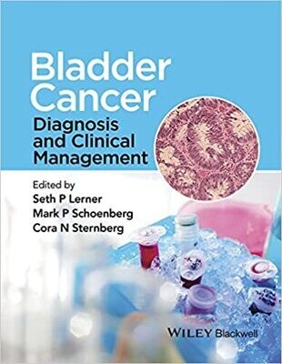 Bladder Cancer: Diagnosis and Clinical Management 1st Edition