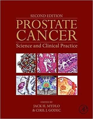 Prostate Cancer: Science and Clinical Practice 2nd Edition