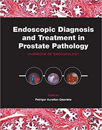 Endoscopic Diagnosis and Treatment in Prostate Pathology: Handbook of Endourology 1st Edition