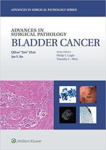 Advances in Surgical Pathology: Bladder Cancer First Edition