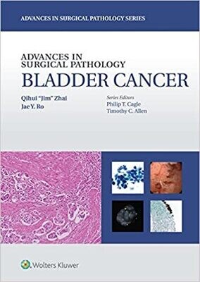 Advances in Surgical Pathology: Bladder Cancer First Edition