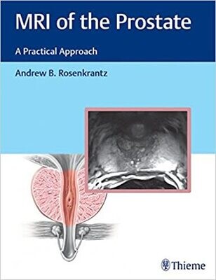 MRI of the Prostate: A Practical Approach 1st Edition
