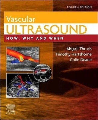 Vascular Ultrasound How, Why and When 2021