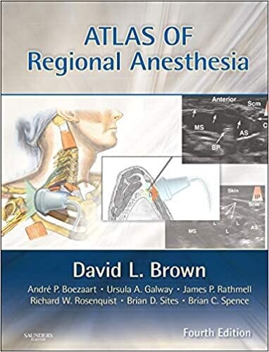 Atlas of Regional Anesthesia: Expert Consult - Online and Print (Brown, Atlas of Regional Anesthesia) 4th Edition