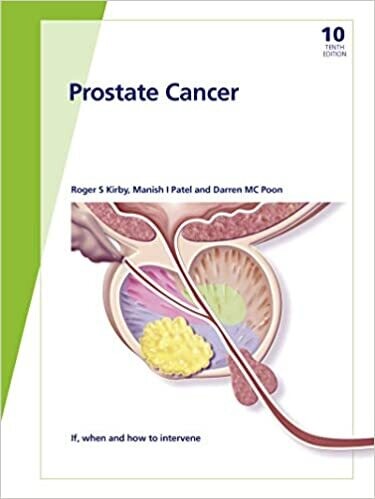 Fast Facts: Prostate Cancer: If, when and how to intervene 10th Edition