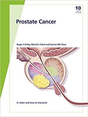 Fast Facts: Prostate Cancer: If, when and how to intervene 10th Edition