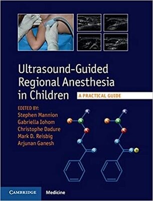 Ultrasound-Guided Regional Anesthesia in Children: A Practical Guide 1st Edition