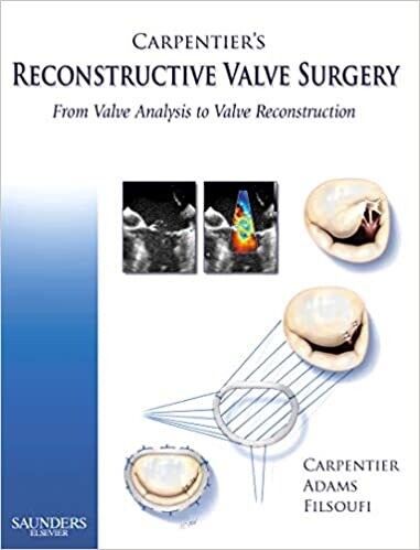 Carpentier&#39;s Reconstructive Valve Surgery, 1e 1st Edition