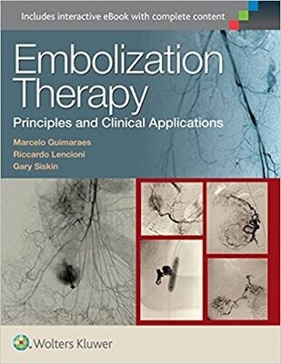 Embolization Therapy: Principles and Clinical Applications First Edition