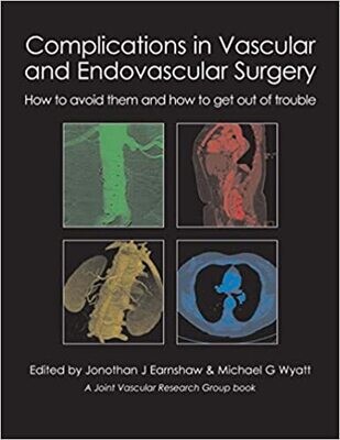 Complications in Vascular and Endovascular Surgery: How to avoid them and how to get out of trouble 1st Edition
