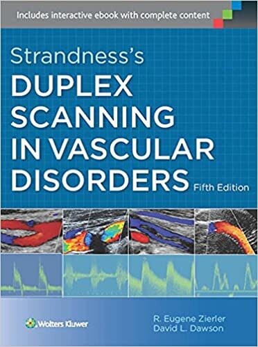 Strandness&#39;s Duplex Scanning in Vascular Disorders Fifth Edition