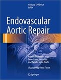 Endovascular Aortic Repair: Current Techniques with Fenestrated, Branched and Parallel Stent-Grafts 1st ed. 2017 Edition