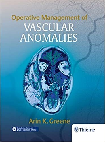 Operative Management of Vascular Anomalies 1st Edition