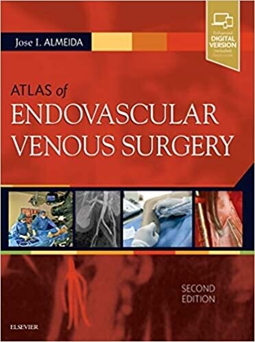 Atlas of Endovascular Venous Surgery: Expert Consult - Online and Print 2nd Edition