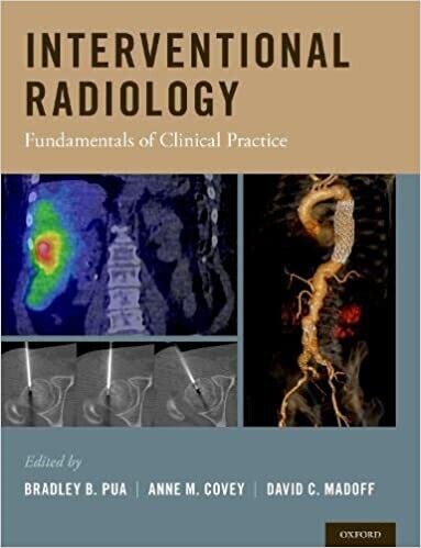 Interventional Radiology: Fundamentals of Clinical Practice 1st Edition