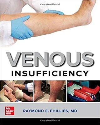 Venous Insufficiency 1st Edition
