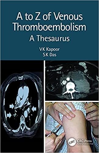 A to Z of Venous Thromboembolism: A Thesaurus 2nd Edition