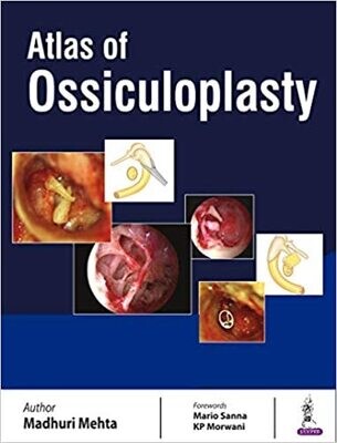 Atlas of Ossiculoplasty 1st Edition