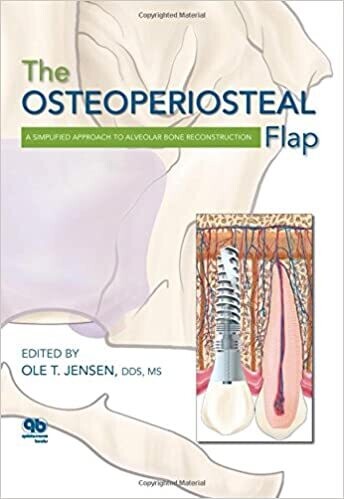 The Osteoperiosteal Flap: A Simplified Approach to Alveolar Bone Reconstruction 1st Edition