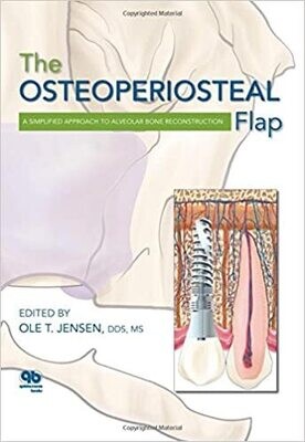 The Osteoperiosteal Flap: A Simplified Approach to Alveolar Bone Reconstruction 1st Edition