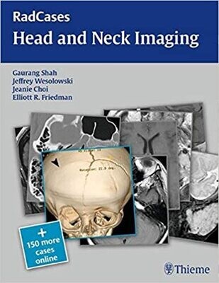 RadCases Head and Neck Imaging (Radcases Plus Q&amp;A) 1st Edition
