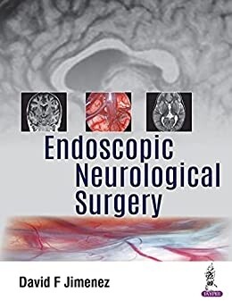 Endoscopic Neurological Surgery 2021