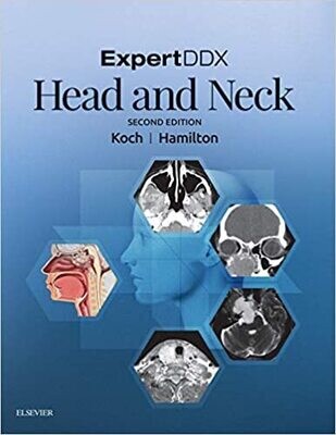 ExpertDDX: Head and Neck - E-Book 2nd Edition