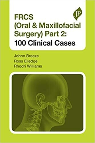 FRCS (Oral &amp; Maxillofacial Surgery) Part 2: 100 Clinical Cases 1st Edition