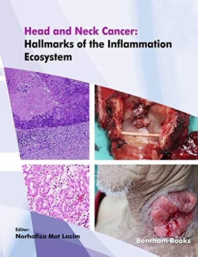Head and Neck Cancer: Hallmarks of The Inflammation Ecosystem-Volume 2