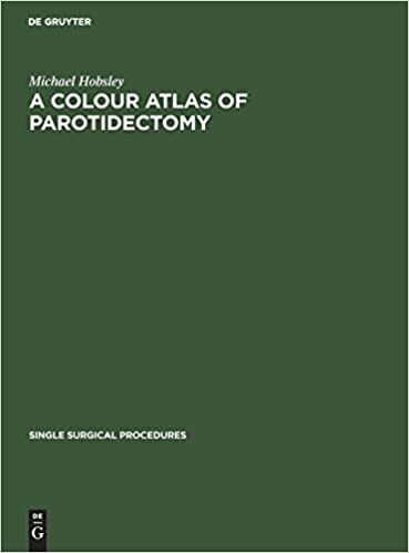 A Colour Atlas of Parotidectomy (Single Surgical Procedures, 1) (German Edition)