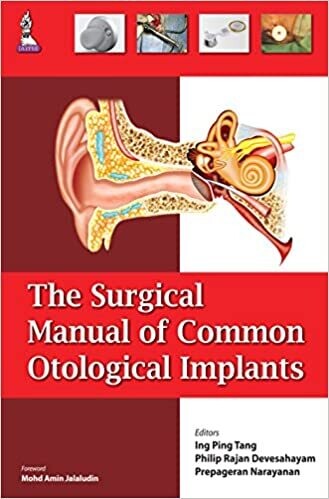 The Surgical Manual of Common Otological Implants 1st Edition