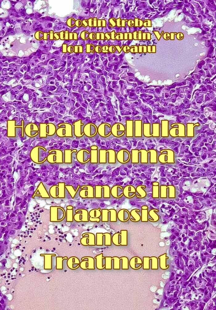Hepatocellular Carcinoma: Advances in Diagnosis and Treatment