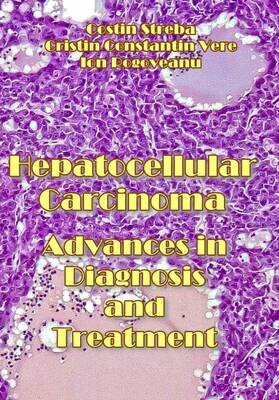 Hepatocellular Carcinoma: Advances in Diagnosis and Treatment