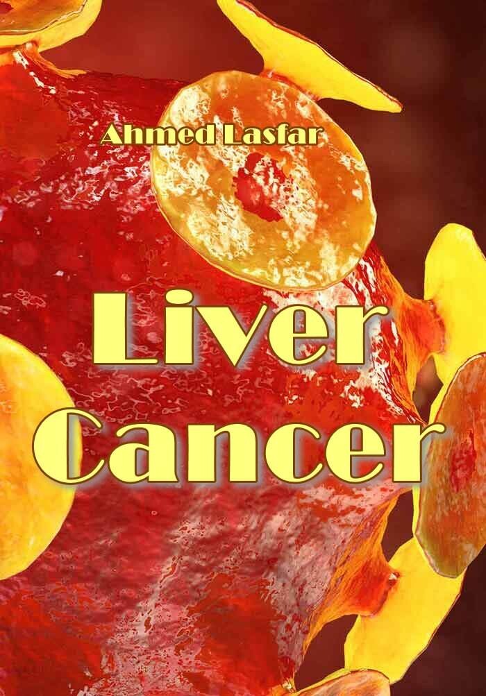 Liver Cancer