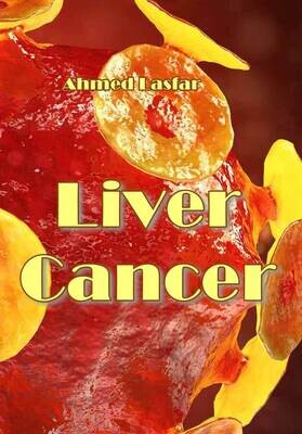 Liver Cancer