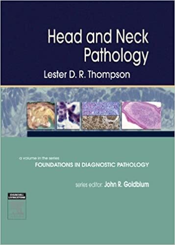 Head and Neck Pathology: A Volume in Foundations in Diagnostic Pathology Series 1st Edition