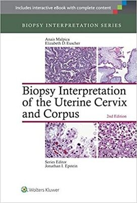 Biopsy Interpretation of the Uterine Cervix and Corpus (Biopsy Interpretation Series) Second Edition