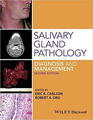 Salivary Gland Pathology: Diagnosis and Management 2nd Edition