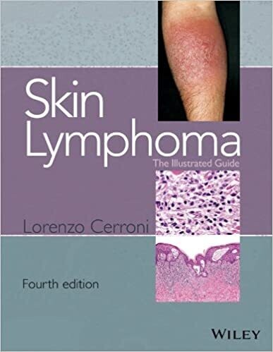 Skin Lymphoma: The Illustrated Guide 4th Edition