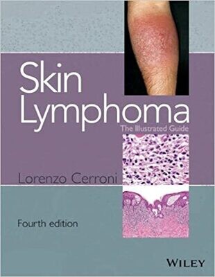 Skin Lymphoma: The Illustrated Guide 4th Edition